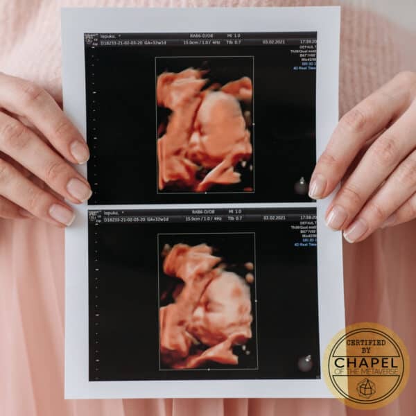 nft ultrasound baby cotm
